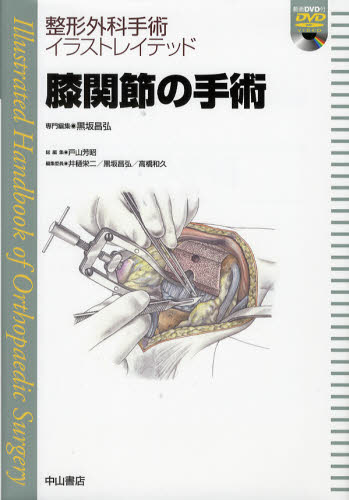 上腕・肘・前腕の手術 金谷文則