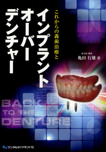 これからの義歯治療とインプラントオーバーデンチャー 亀田行雄／著 基礎歯科学の本の商品画像