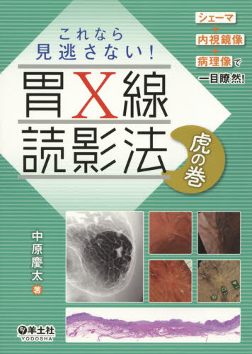 これなら見逃さない！胃Ｘ線読影法虎の巻　シェーマ＋内視鏡像＋病理像で一目瞭然！ （シェーマ＋内視鏡像＋病理像で一目瞭然！） 中原慶太／著 画像診断、超音波診断学の本の商品画像