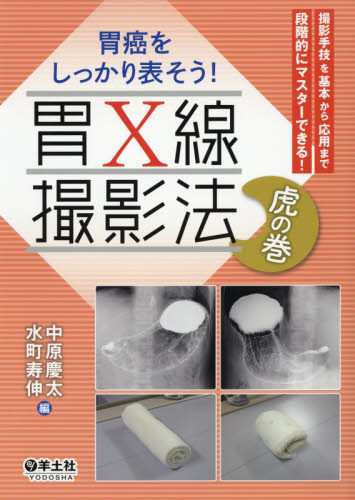 胃癌をしっかり表そう！胃Ｘ線撮影法虎の巻　撮影手技を基本から応用まで段階的にマスターできる！ 中原慶太／編　水町寿伸／編